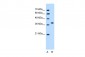 RUNDC2A antibody - N-terminal region